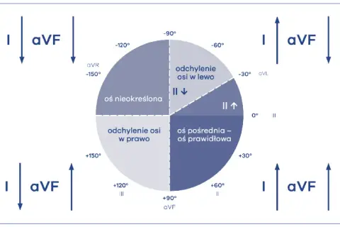 Lewogram patologiczny EKG: Co to znaczy? Przyczyny i co dalej