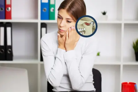 Donna con dolore alla mandibola, immagine anatomica dell'articolazione temporo-mandibolare. Un gnatologo cosa fa? Aiuta a risolvere questi problemi.