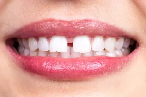 Labbra rosse e sorridenti rivelano un diastema tra i denti, uno spazio che rende unico il sorriso.