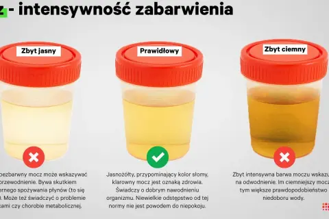Trzy pojemniki z próbkami moczu o różnym zabarwieniu: zbyt jasnym, prawidłowym i zbyt ciemnym.