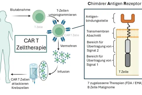 Schema der CAR T-Zelltherapie: T-Zellen werden entnommen, umprogrammiert und vermehrt, bevor sie als Infusion Krebszellen attackieren. Der chimäre Antigenrezeptor wird detailliert dargestellt.