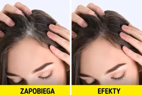 Jak zapobiec siwieniu włosów – skuteczne metody i naturalne sposoby na młodszy wygląd