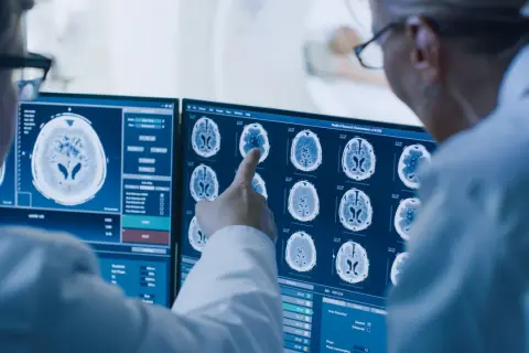 Guz mózgu objawy psychiczne - jak rozpoznać niepokojące symptomy