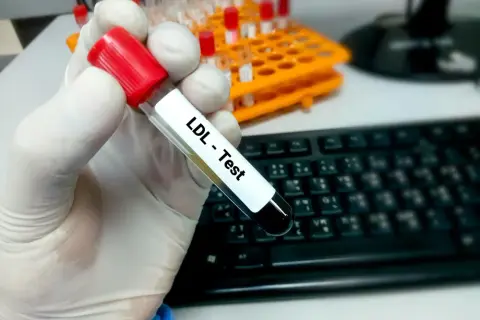 Jak bezpiecznie podnieść cholesterol? Sprawdź skuteczne metody i porady