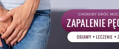 Zapalenie pęcherza: do ginekologa czy internisty? Kto pomoże szybciej?