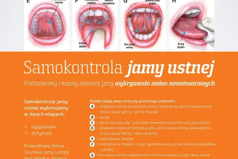 Choroby jamy ustnej: do jakiego lekarza się udać i jak uniknąć powikłań