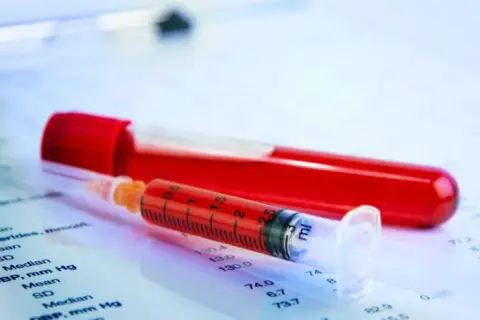 Co oznacza WBC w badaniu krwi: Kluczowe informacje o leukocytach