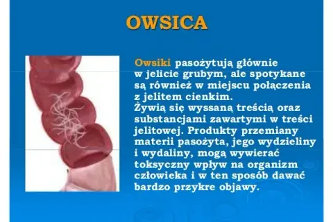 Owsiki a przedszkole: najważniejsze zasady postępowania dla rodziców