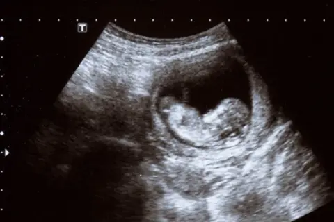 Jak wygląda dziecko w 7 tygodniu ciąży? Niesamowite zmiany w twoim brzuchu