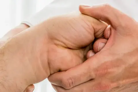 Arzt untersucht Hand, tastet den Os lunatum ab.