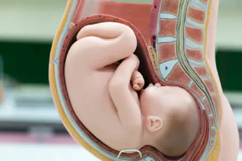 Model anatomiczny pokazuje prawidłowe ułożenie dziecka do porodu – główka skierowana w dół, zgięta.