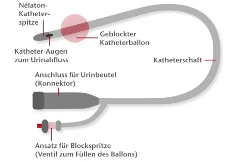 Schema eines Katheters für den Mann: Nélaton-Spitze, Ballon, Anschluss für Urinbeutel und Ansatz für Blockspritze.