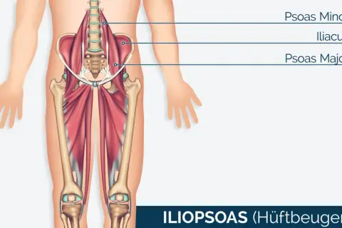 Der Iliopsoas-Muskel, auch Hüftbeuger genannt, mit dem prominenten psoas major, ist im menschlichen Becken und Oberschenkel dargestellt.