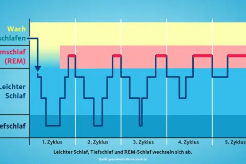 Grafik zeigt, welche Schlafphasen es gibt: Wach, Leichtschlaf, Tiefschlaf und Traumschlaf (REM). Diese wechseln sich zyklisch ab.