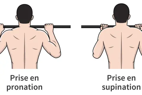 Comparaison des prises pronation et supination pour la traction. Attention à la douleur épaule traction, la prise supination peut être plus douce.