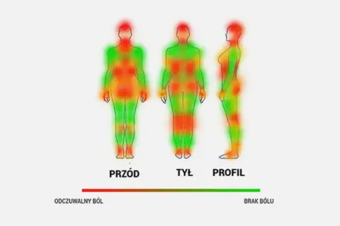 Mapy pokazujące próg bólu dla tatuażu. Czerwone obszary oznaczają większą wrażliwość, zielone mniejszą.