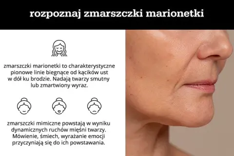Skuteczne metody na zmarszczki po 50, które naprawdę działają