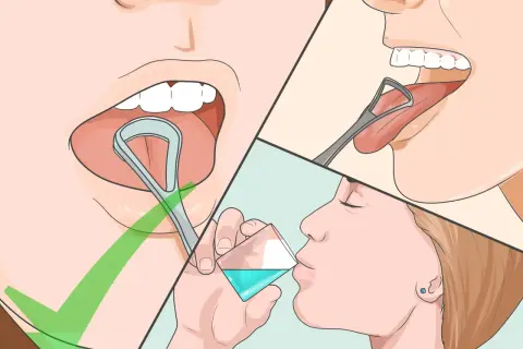 Immagine mostra come pulire la lingua con un puliscilingua e poi sciacquare la bocca.