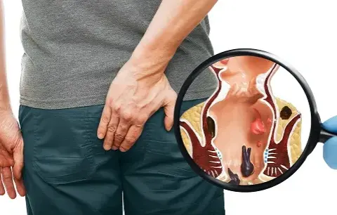 Nie wstydź się! Proktolog: Kiedy iść i jak wygląda wizyta?
