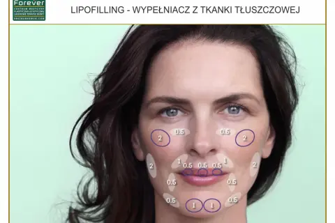 Liposukcja kawitacyjna: Ile zabiegów? Konkretne liczby i efekty