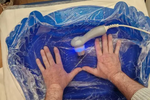Mani immerse in un bagno blu per ultrasuoni in acqua per piedi, con un manipolo che emette luce blu.