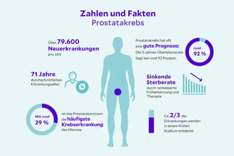 Zahlen & Fakten zu Prostatakrebs: Über 79.600 Neuerkrankungen/Jahr, 71 Jahre Durchschnittsalter. Gute Prognose: 92% Überleben. Prostatakrebs ist heilbar, wenn früh erkannt.