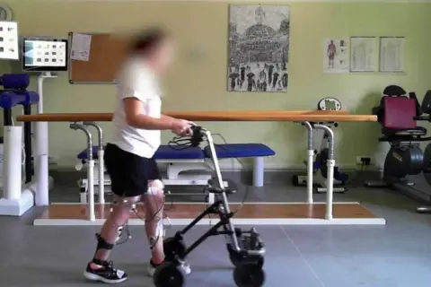 Persona con invalidità cammina con deambulatore, sensori alle gambe per neurostimolatore midollare.