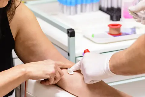 Pobieranie krwi do badań. Pacjentka ma lekko widoczne żyły, co ułatwia procedurę. Wyniki badań MPV niskie mogą wskazywać na pewne schorzenia.