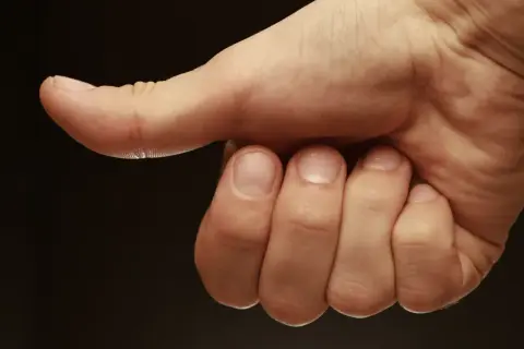 Main d'une personne montrant le pouce, comme pour donner un avis positif. La prothèse du pouce avis est ici symbolisée par ce geste.