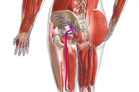 Dettaglio anatomico del bacino e delle gambe, con evidenziati i muscoli, i vasi sanguigni e i nervi. L'infiammazione nervi può causare dolore in quest'area.
