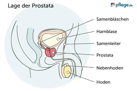 Anatomische Darstellung der Prostata. Bei fortgeschrittenem Prostatakrebs mit Streuung kann die Lebenserwartung variieren.