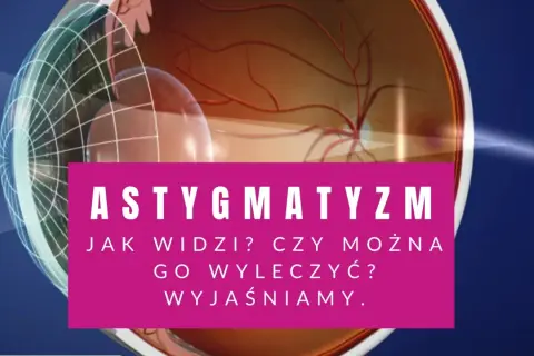 Przekrój oka z siatkówką i tekstem "ASTYGMATYZM".