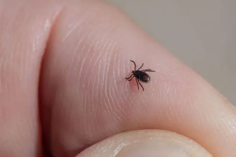 Mały kleszcz na ludzkiej skórze. Zastanawiasz się, jak długo kleszcz siedzi w skórze? Im szybciej go usuniesz, tym lepiej.
