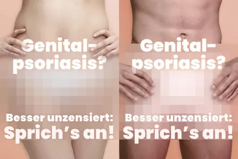Genital-Psoriasis? Zwei Körper zeigen, dass es besser ist, offen darüber zu sprechen.