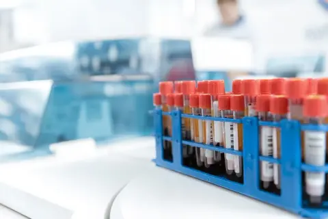 Badania hematologiczne: Co to jest i co mówią o Twoim zdrowiu?