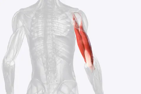 Der Triceps brachii Muskel am menschlichen Oberarm, rot hervorgehoben.