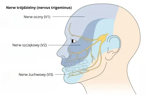 Schematyczny rysunek głowy z zaznaczonymi obszarami unerwienia nerwu trójdzielnego: nerw oczny (V1), szczękowy (V2) i żuchwowy (V3).