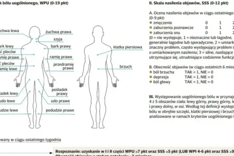 Schemat przedstawia lokalizację bólu w fibromialgii. Co to jest fibromialgia? To zespół objawów, m.in. bólu, zmęczenia, zaburzeń snu.