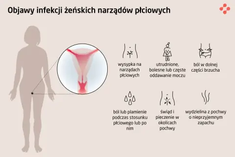 Objawy infekcji narządów płciowych: wysypka, ból brzucha, problemy z oddawaniem moczu, ból podczas stosunku, świąd, pieczenie i nieprzyjemna wydzielina. To mogą być symptomy choroby wenerycznej.