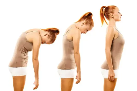 Tre pose a confronto: una donna con postura scorretta in piedi, poi leggermente meglio, e infine con postura corretta in piedi.