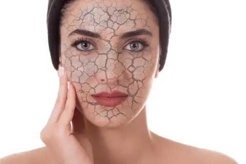 Rostro de mujer con piel agrietada, simulando el daño del estrés oxidativo.