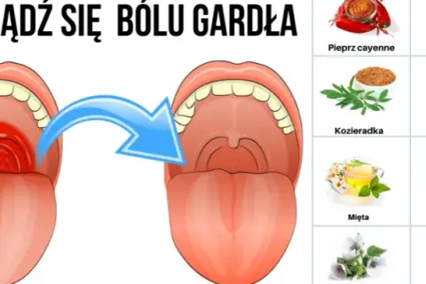 Skuteczne i bezpieczne sposoby na zapalenie gardła u dziecka – co działa najlepiej?