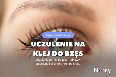 Czerwone, podrażnione oko z widocznym uczuleniem na klej do rzęs. Artykuł omawia objawy i przyczyny.