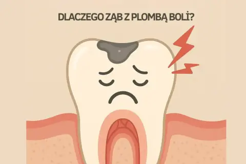 Smutny ząb z plombą i czerwonymi błyskawicami bólu. Dlaczego ząb z plombą boli?