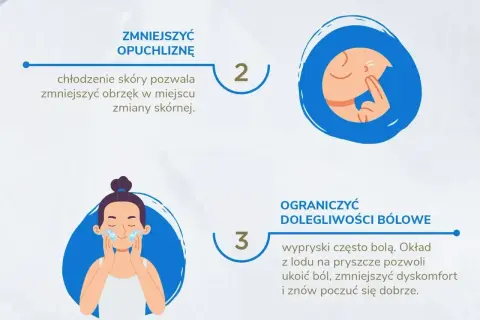 Zimny okład na pryszcze zmniejsza obrzęk i ból. Chłodzenie skóry przynosi ulgę.