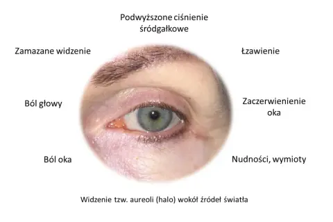 Ile trwa atak jaskry? Działaj szybko, by ratować wzrok!