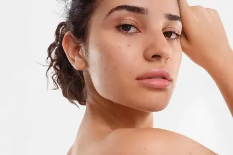 Une jeune femme au visage naturel, avec quelques imperfections, pose pour montrer comment avoir un beau visage.