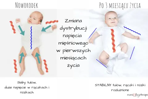 Wzmożone napięcie mięśniowe u niemowląt: Rozpoznaj objawy i działaj