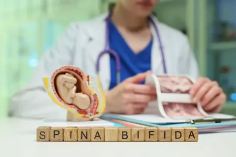 Model płodu i klocki z napisem SPINA BIFIDA. Lekarz analizuje wyniki badań prenatalnych, pokazując potencjalne ryzyko rozszczepu kręgosłupa.