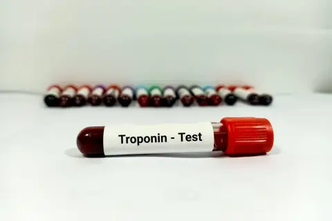 Troponina - co to za badanie i jak wpływa na zdrowie serca?